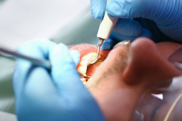 Best Emergency Root Canal Treatment in Hooper, UT
