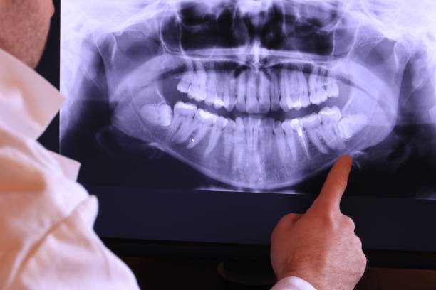 Best Emergency Treatment for Toothache in Hooper, UT