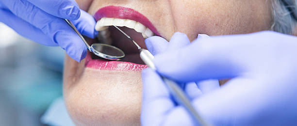 Best Emergency Dental Surgery in Hooper, UT